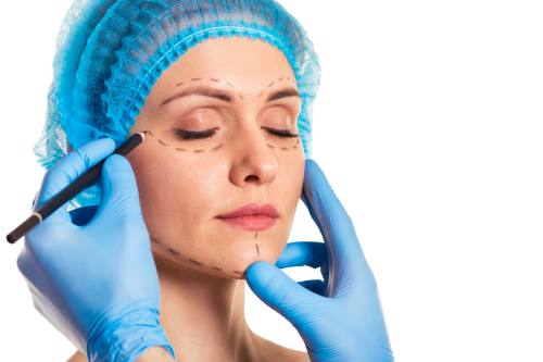 Blefaroplastia superior en cdmx