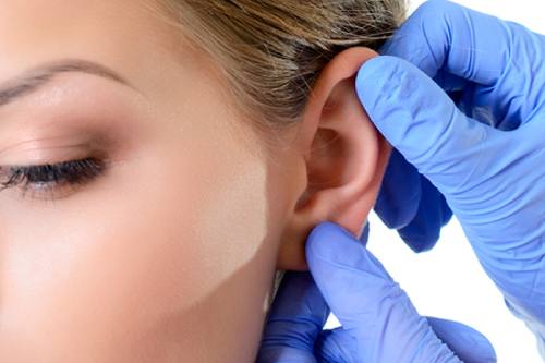 Otoplastia en cdmx